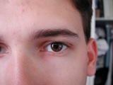 Eyes