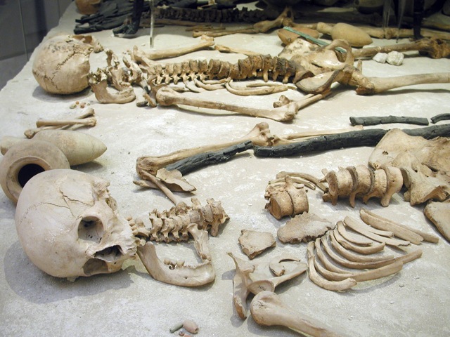 Bones