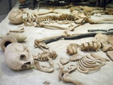 Bones
