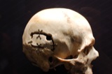 Bones
