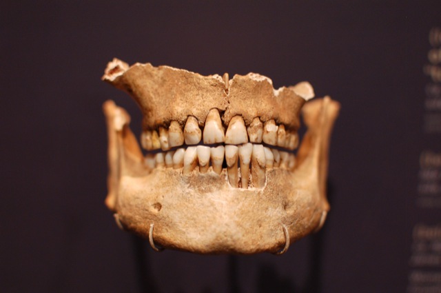 Bones