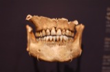 Bones