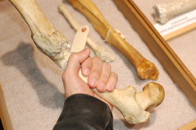 Bones